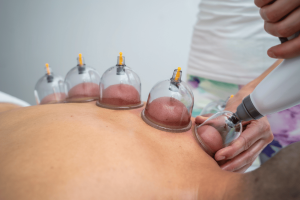 hijama sèche ventouses